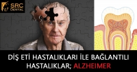 Diş Eti Hastalıkları ile Bağlantılı Hastalıklar, ALZHEIMER