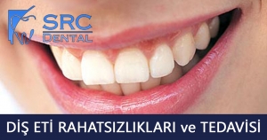 Diş Eti Çekilmesi: Nedenleri ve Tedavi Yöntemleri