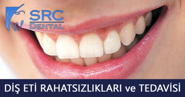 Diş Eti Çekilmesi: Nedenleri ve Tedavi Yöntemleri